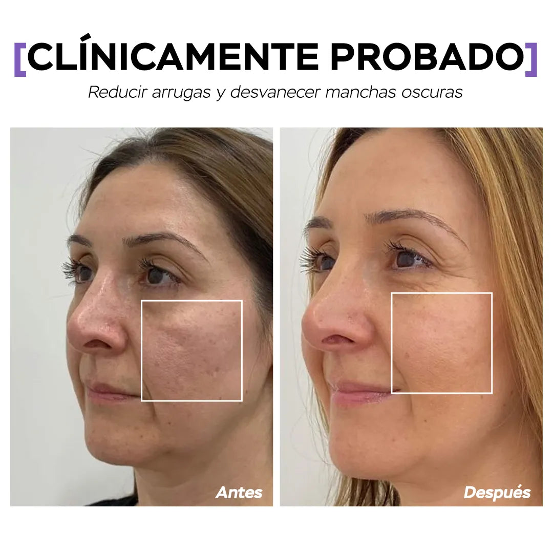 Crema con Retinol